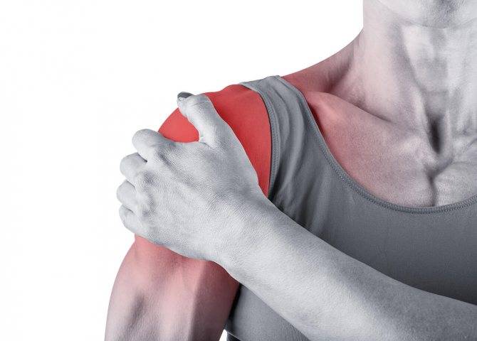 Синовит плечевого сустава: что это такое, симптомы и лечение