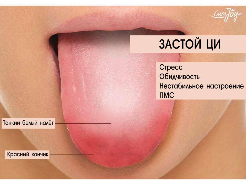 Горечь при гастрите во рту: причины и лечение народными средствами