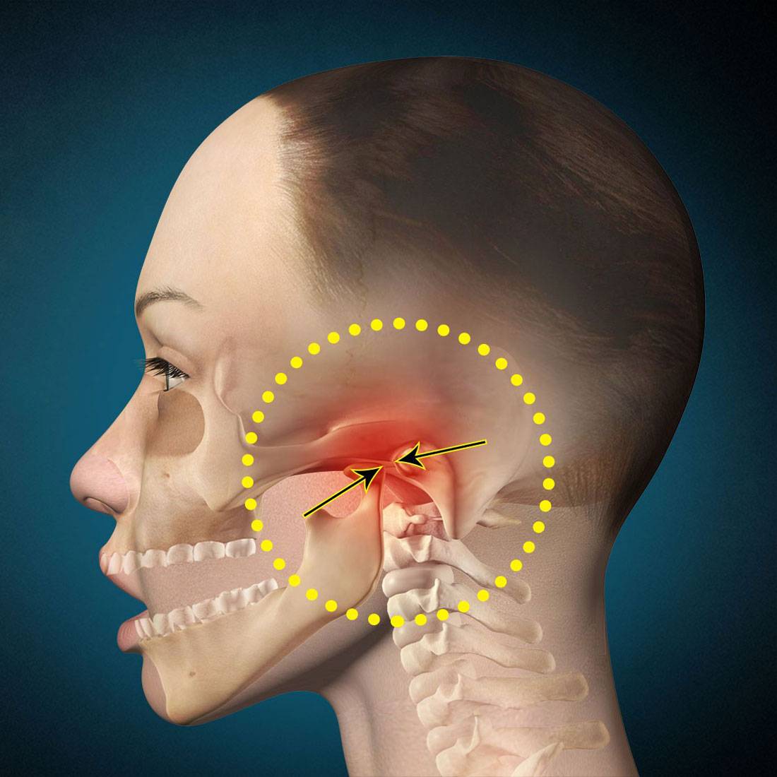 Боль в ухе при глотании: причины, симптомы, лечение, почему болит ухо при глотании, что делать, нужно ли обращаться к врачу