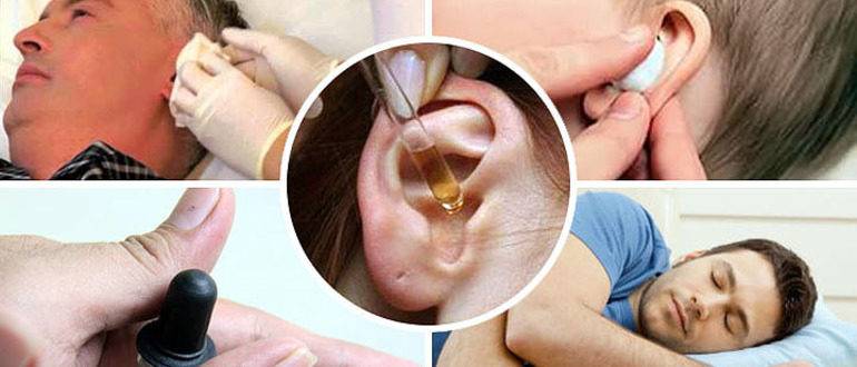 Болит горло закладывает уши без температуры