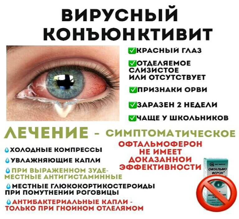 Глаукома - симптомы, причины, признаки и лечение народными средствами, разновидности заболевания