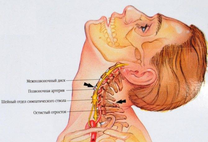 Онемение и жжение языка при шейном остеохондрозе – это один из симптомов проблем с позвоночником