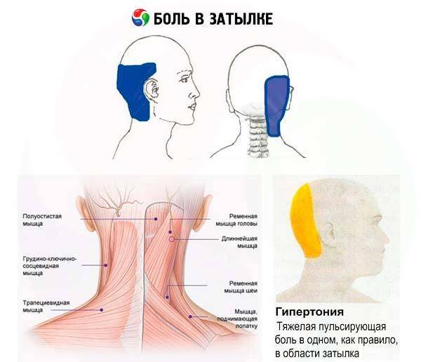 Болит шея сзади у основания черепа и шеи, причины боли
