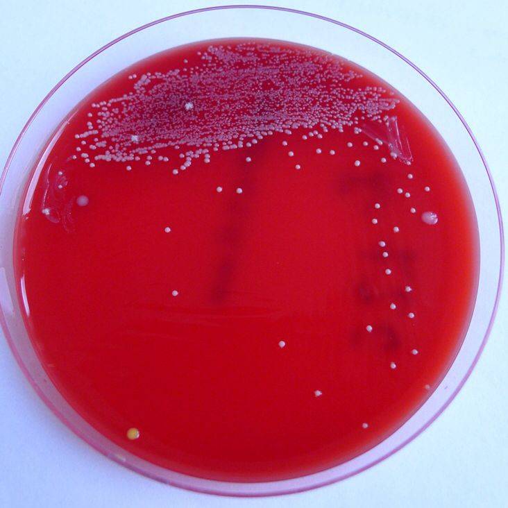 Условно-патогенные микроорганизмы рода moraxella | интернет-издание "новости медицины и фармации"