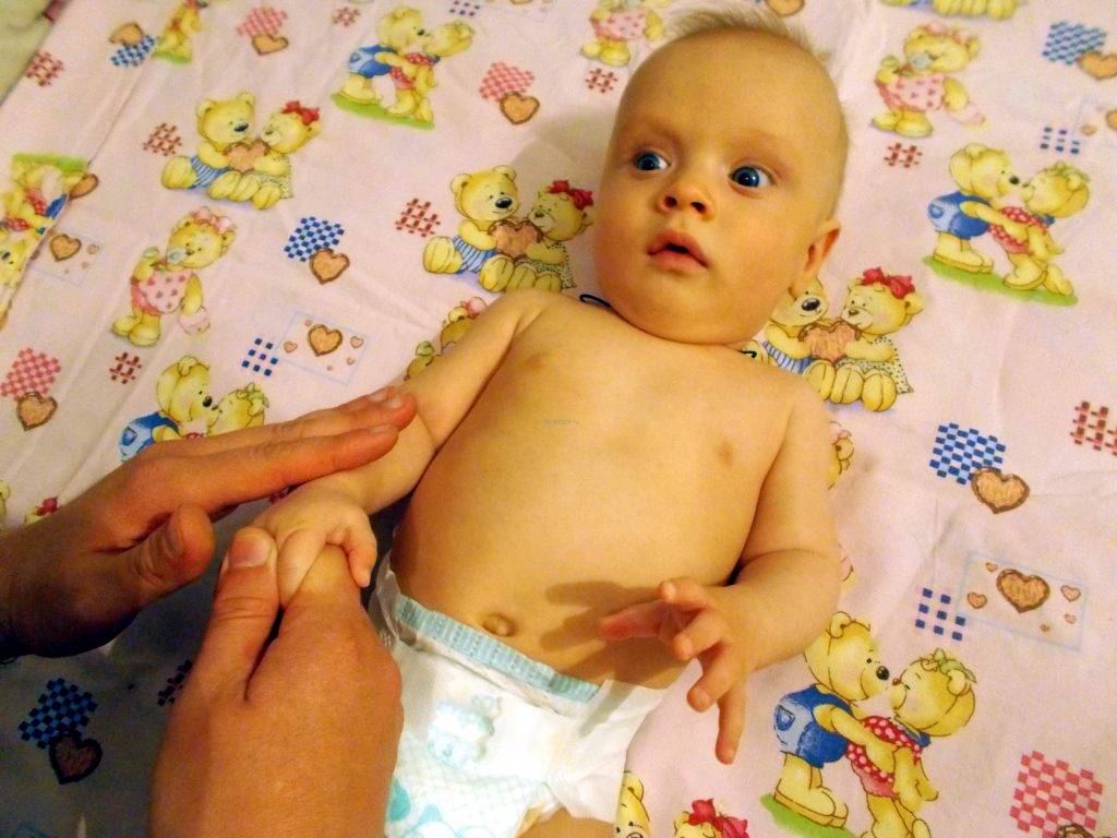 Разит купить. Перинатальная энцефалопатия у новорожденных. Энцефалопатия у детей симптомы. Новорожденный ребенок с энцефалопатией. Энцефалопатия у грудничка.