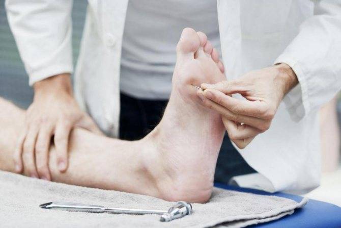 Почему немеют руки и ноги — что делать, как лечить онемение конечностей?