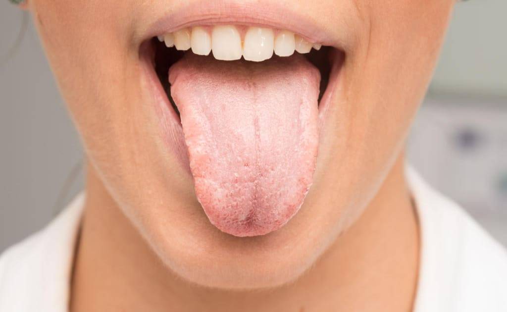 Жжение языка: причины, диагностика, лечение. чем может быть вызвано и как избавиться?