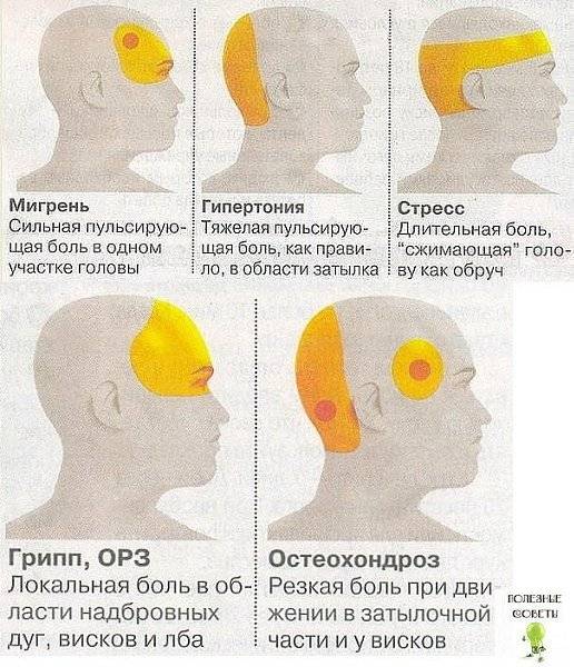 Болит левый затылок головы и левый висок. 
болит голова в затылке. headnothurt.ru