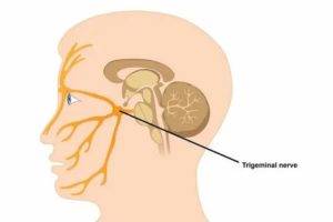 Неврит лицевого нерва: симптомы, причины, лечение. чем лечить неврит в домашних условиях