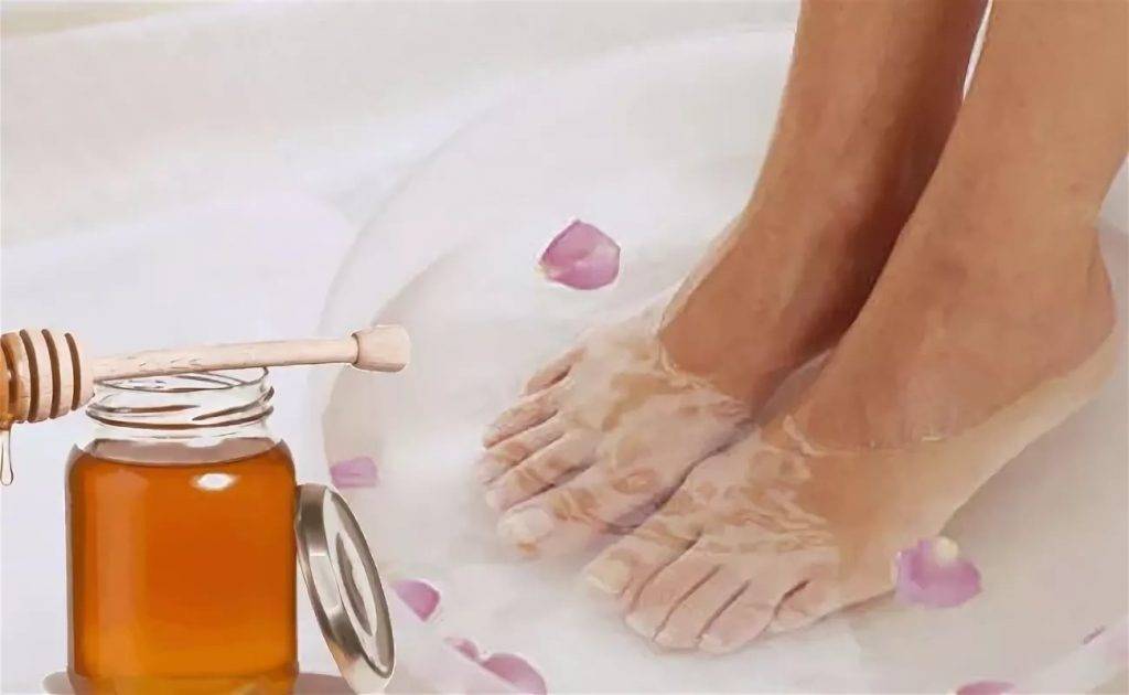 Трещины на пальцах ног - почему появляются, как лечить раны препаратами и народными средствами, профилактика поражения кожи