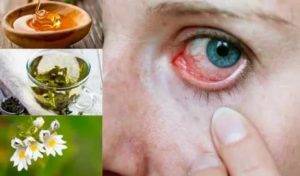 Как снять воспаление глаз в домашних условиях - народные средства