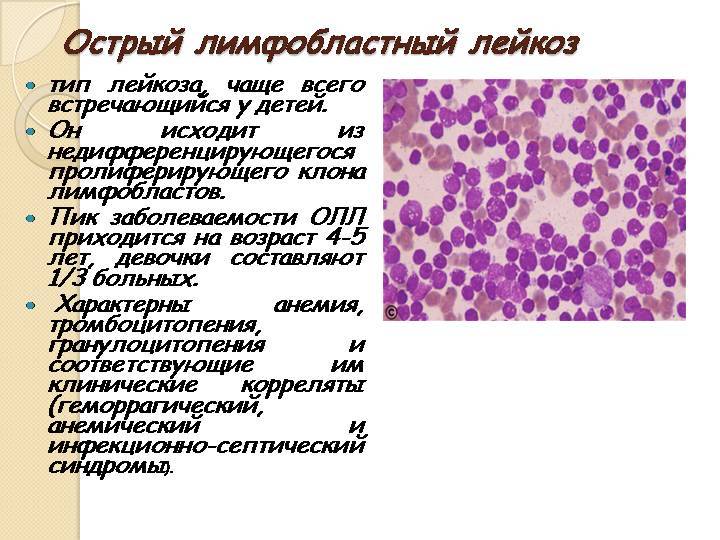 Повышены лимфоциты в крови у ребенка: причины и лечение