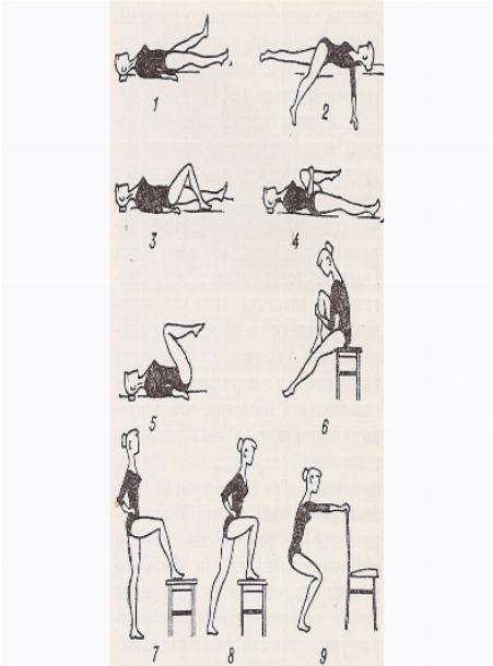 Какие упражнения при артрозе коленного сустава