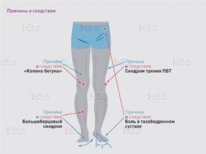 Тянущая боль в правой ноге от колена до стопы | spinahelp.ru
