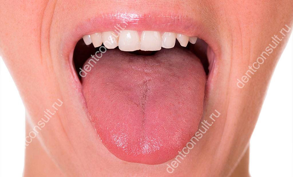 Белый налёт на языке у взрослых: причины и лечение, сопутствующие горечь и сухость во рту, что это означает и как избавиться