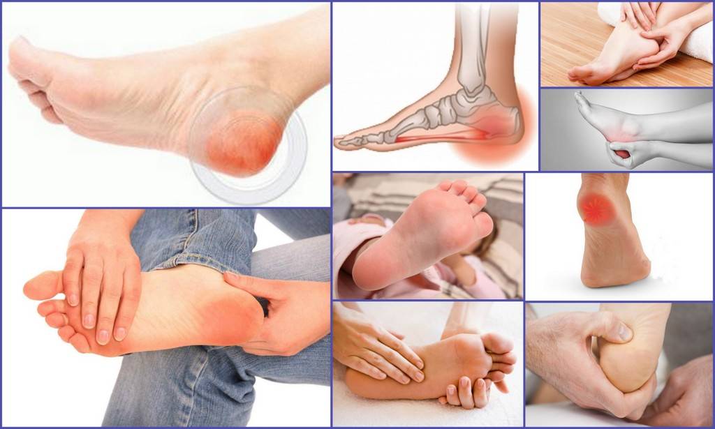 Боль в ноге от бедра до колена: причины, почему болит, лечение