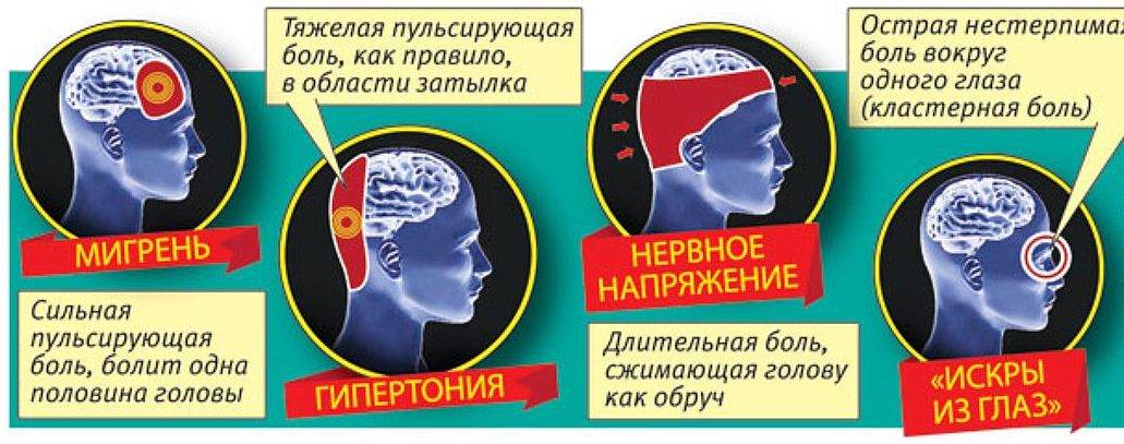 Мигрень: 19 средств, которые помогут избавиться от головной боли — net-bolezniam.ru
