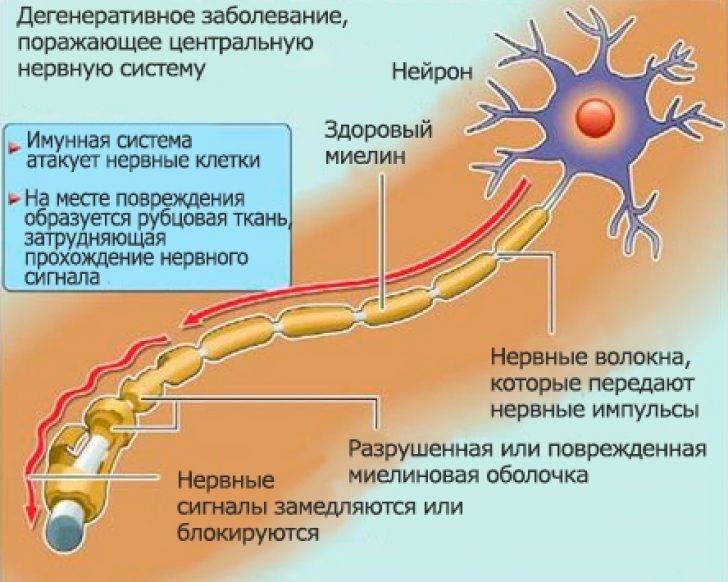 Неврологические проявления covid-19 и других коронавирусов