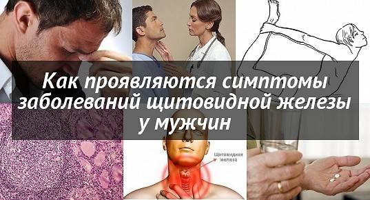 Щитовидная железа - симптомы заболевания у мужчин, лечение и признаки