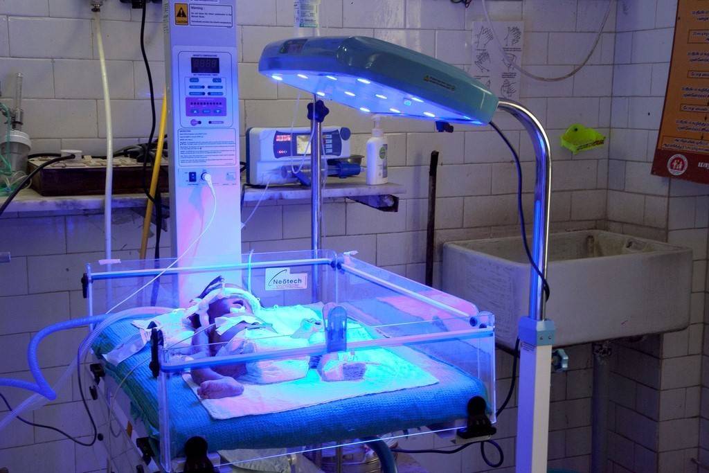 Желтушка у новорожденных: лечение, фототерапия лампой