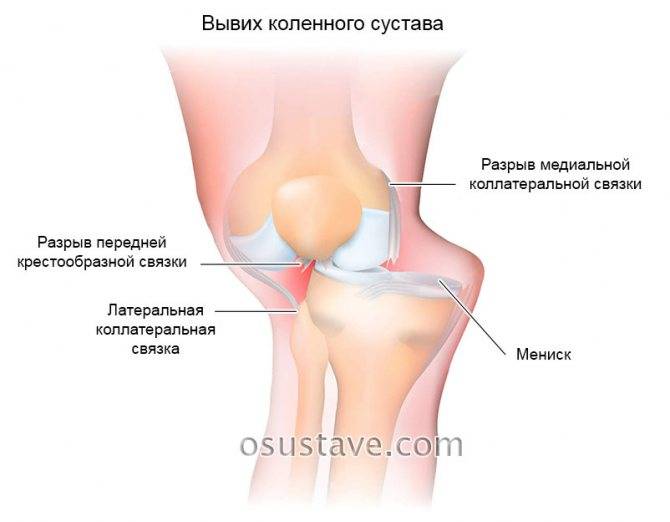 Болит колено при сгибании и разгибании: лечение