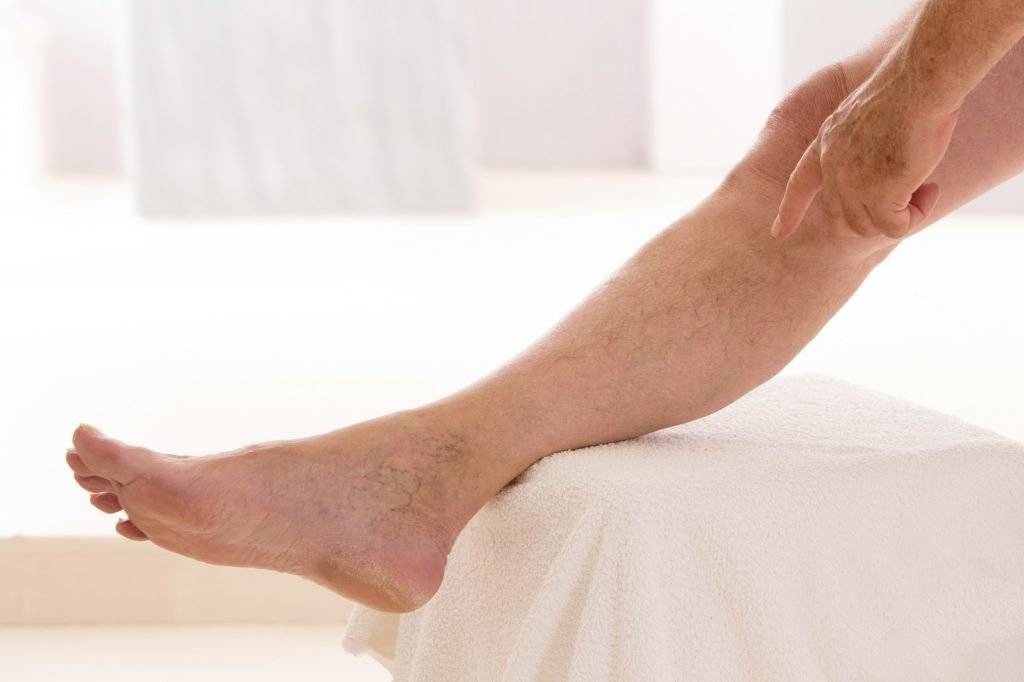 Болят мышцы ног: возможные заболевания и лечение