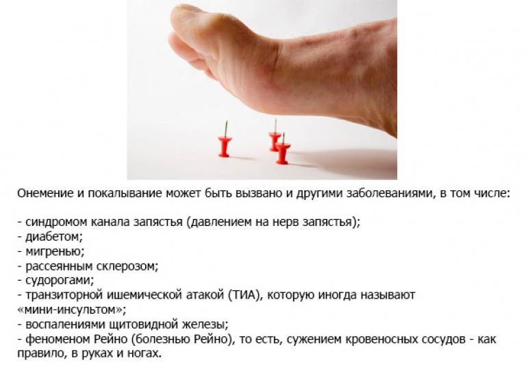 Жжение и покалывание в руках и ногах | spinahelp.ru