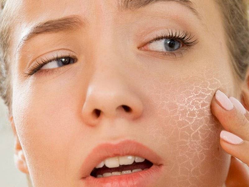 Зуд кожи тела – причины без высыпаний или с сыпью у взрослого