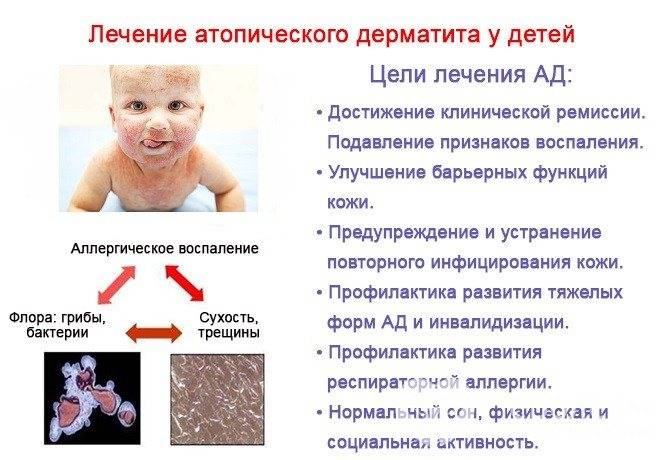 Как вылечить пеленочный дерматит у ребенка: быстрые способы лечения и фото заболевания