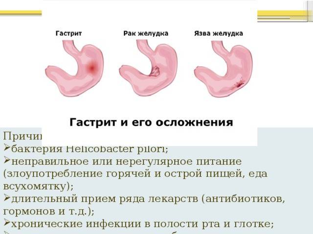 Как проявляется гастрит у грудничка