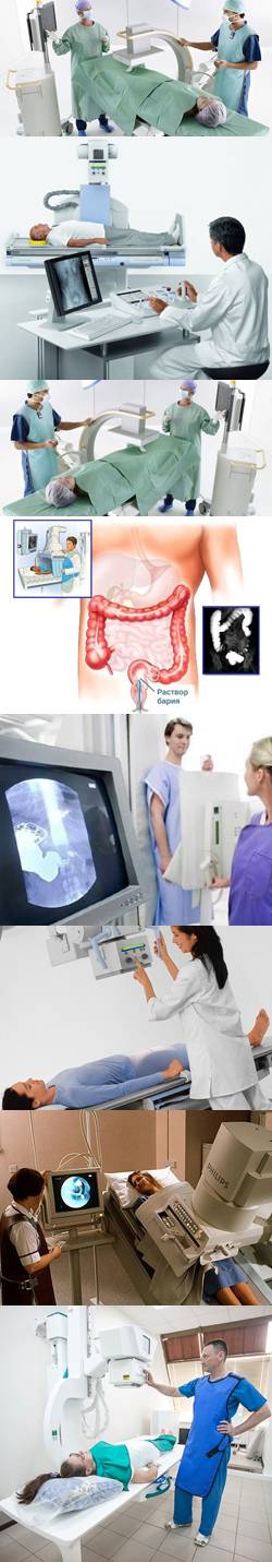Подготовка к рентгену желудка, рентгеноскопия кишечника и пищевода