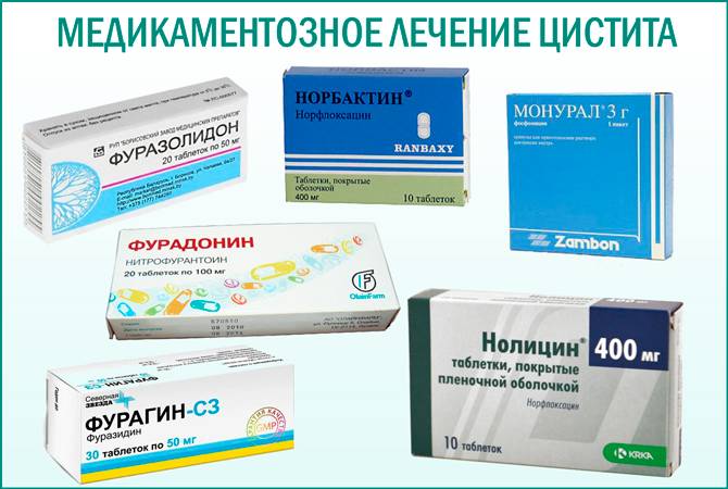 Препараты от цистита у женщин: список, быстрое лечение, противовоспалительные, антибактериальные, обезболивающие