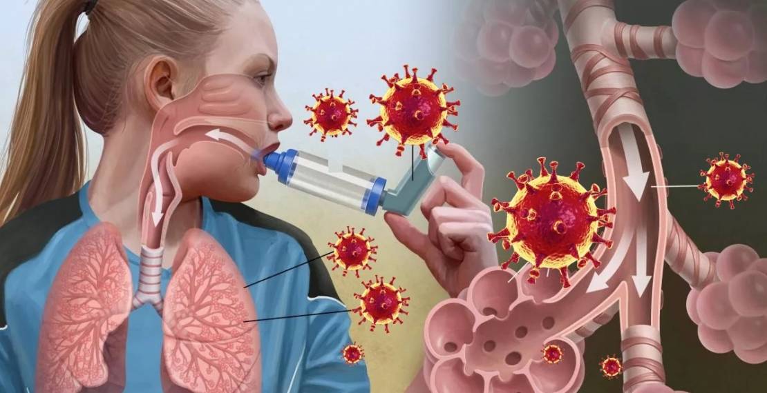 Как отличить коронавирус от аллергии: симптомы, различие