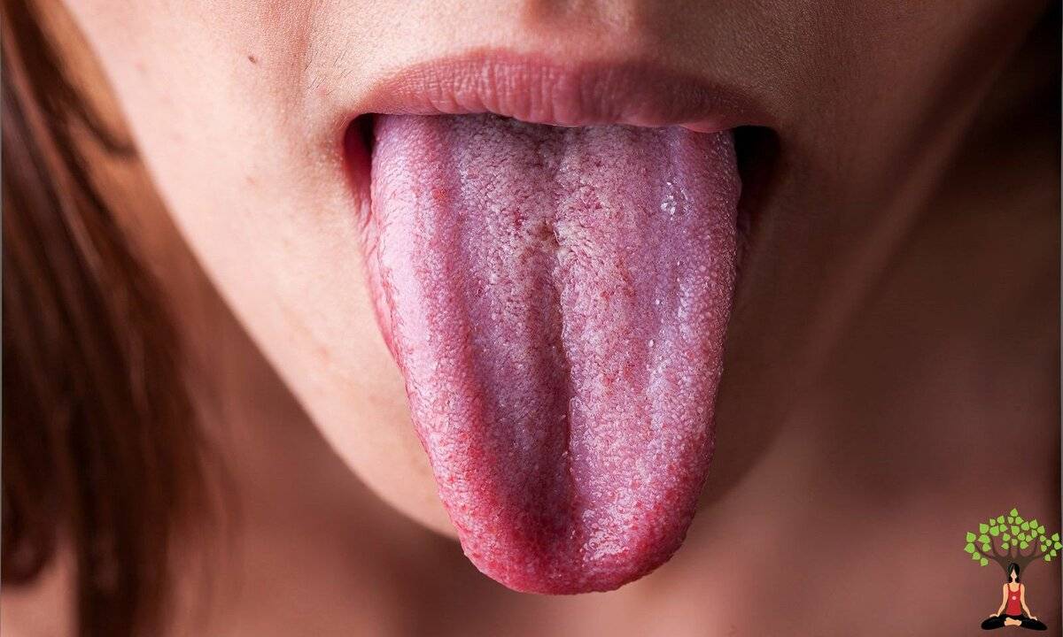 Печет кончик языка: причины дискомфорта, опасно ли это, способы диагностики и лечения
