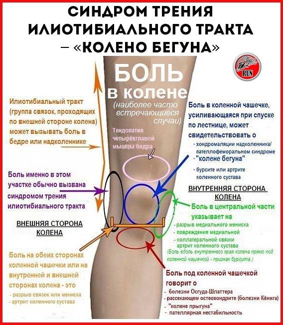 Боль в колене с внешней стороны сбоку — причины, методы лечения