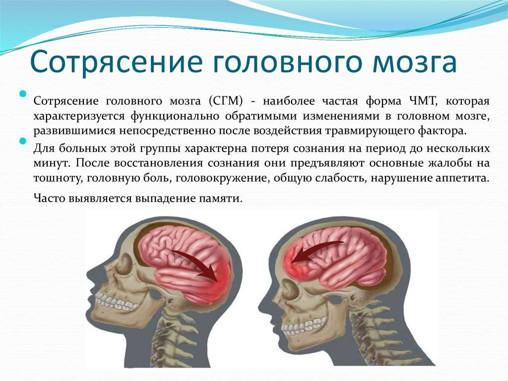 Удар головы затылком. Три основных признака при сотрясении головного мозга.. Симптомом сотрясения головного мозга является. Основной симптом тяжелого сотрясения головного мозга. Симптоматика сотрясения головного мозга обуславливается.