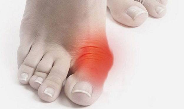 Узнаем, почему болит ноготь на большом пальце ноги при нажатии