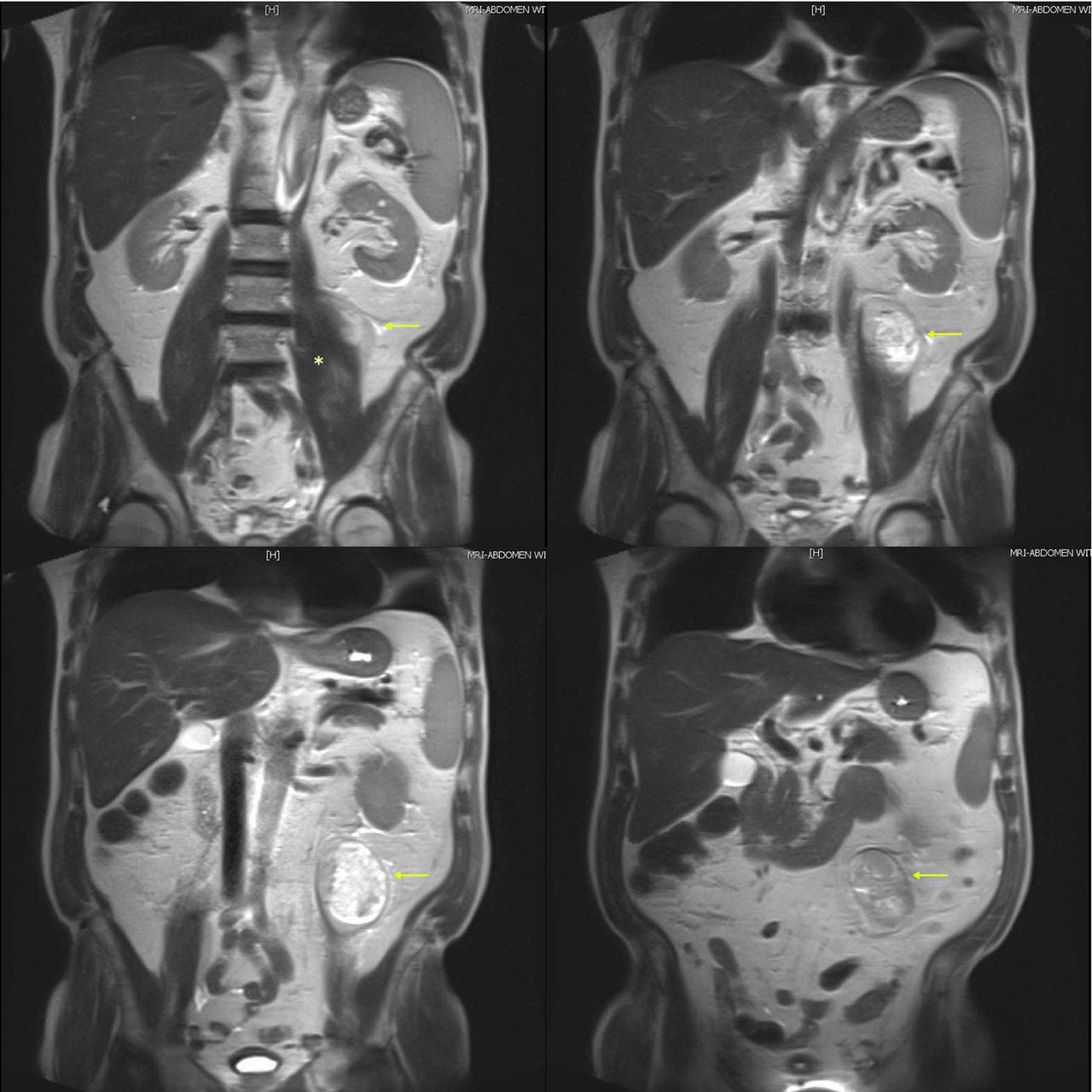 Компьютерная томография органов брюшной полости: показания, противопоказания, подготовка к процедуре