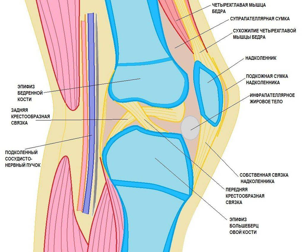 Что такое супрапателлярный бурсит коленного сустава?