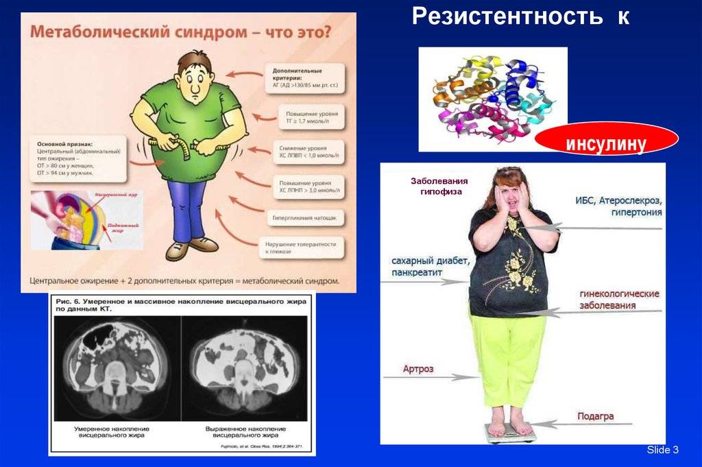Метаболический синдром (дисметаболический) - что это простым языком, причины у женщин и мужчин, лечение препаратами и народными средствами