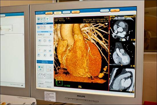Кт сосудов сердца: как подготовиться, что показывает компьютерная томография?