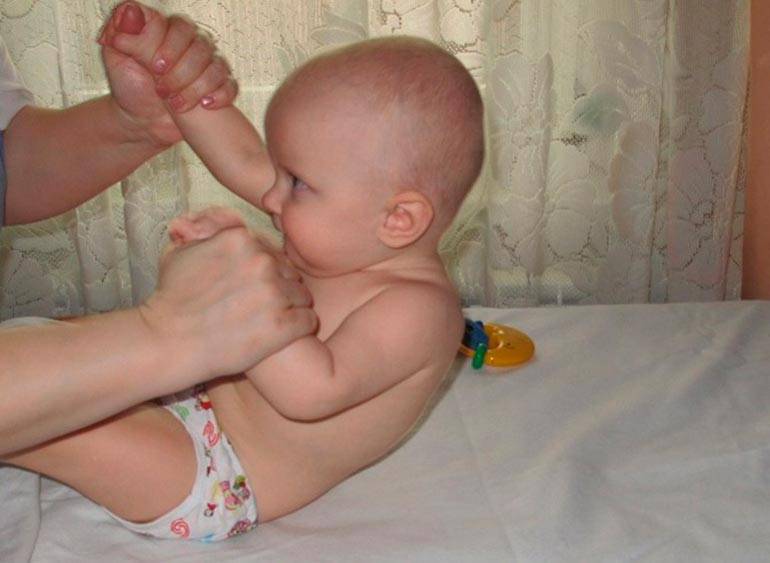 Гипотонус у ребенка: причины и лечение слабого мышечного тонуса