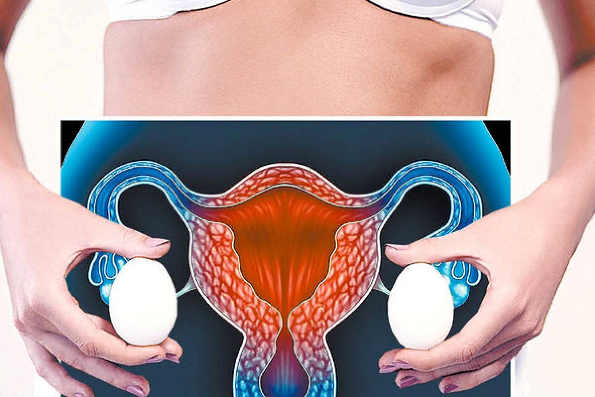Апоплексия яичника: что это такое, и как ее лечить?