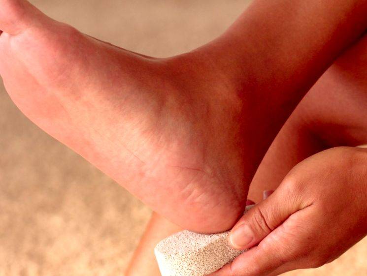 Сухость кожи ног причины и лечение фото у взрослых