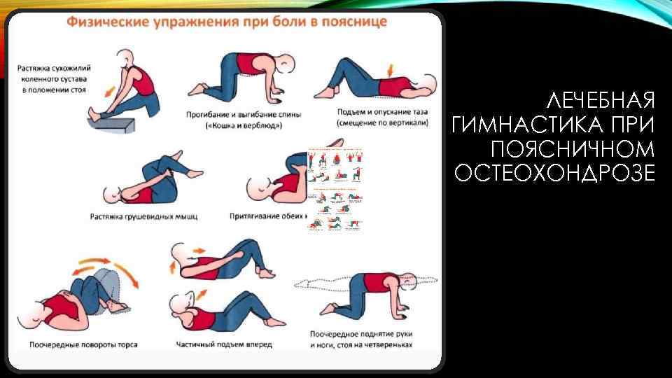 Лечебная гимнастика при остеохондрозе поясничного отдела позвоночника: комплекс упражнений