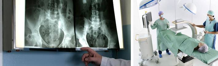 Подготовка к рентгену желудка: алгоритм подготовки к исследованию, диета и питание