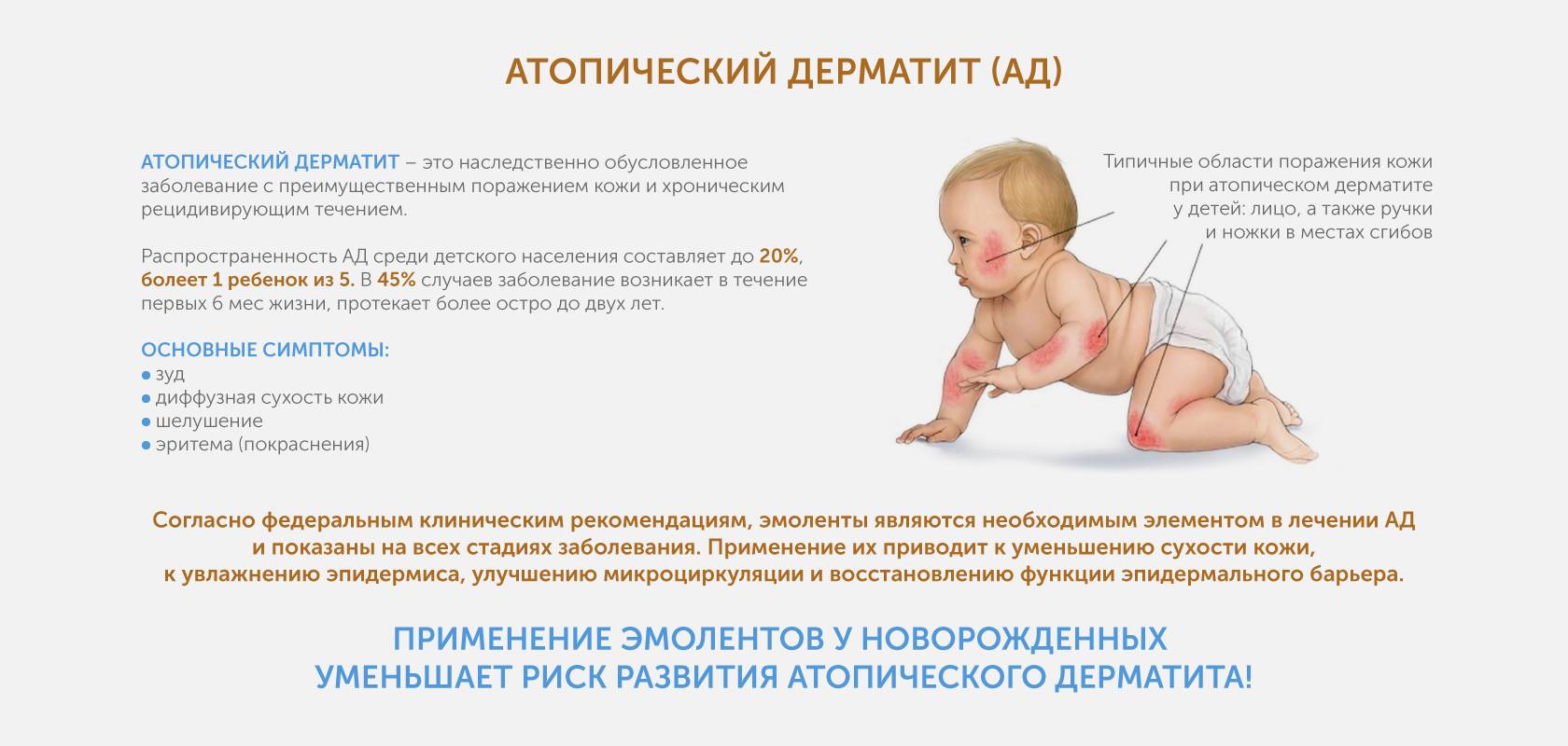 Пеленочный дерматит у новорожденных. фото, лечение, клинические рекомендации