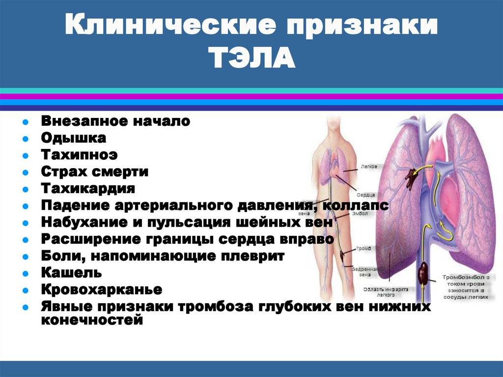 Что такое тромбоэмболия легочной артерии простыми. Легочная тромбоэмболия симптомы. Признаки тромбоэмболии легочной артерии. Тромбоэмболия легочной артерии симптомы. Эмболия легочной артерии симптомы.