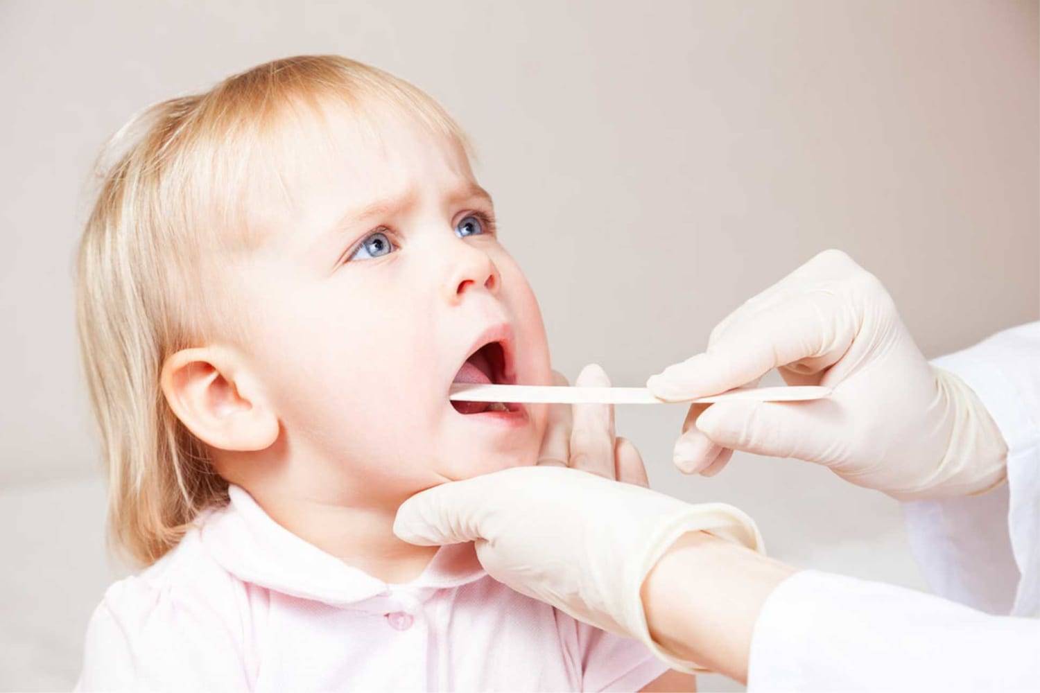 Стафилококк в носу (aureus) у взрослого и ребёнка: симптомы, причины, лечение
