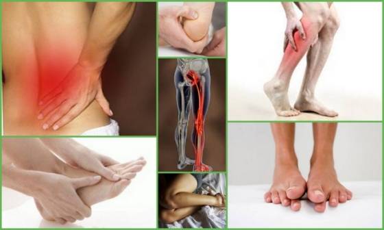 Болят ноги от колена до ступни к какому врачу идти | spinahelp.ru